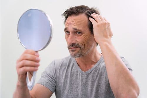 Does creatine cause hair loss?